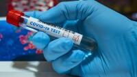 covid test-19-5070657 1280